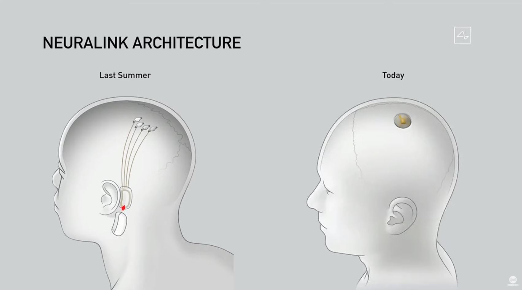 neuralink_arch